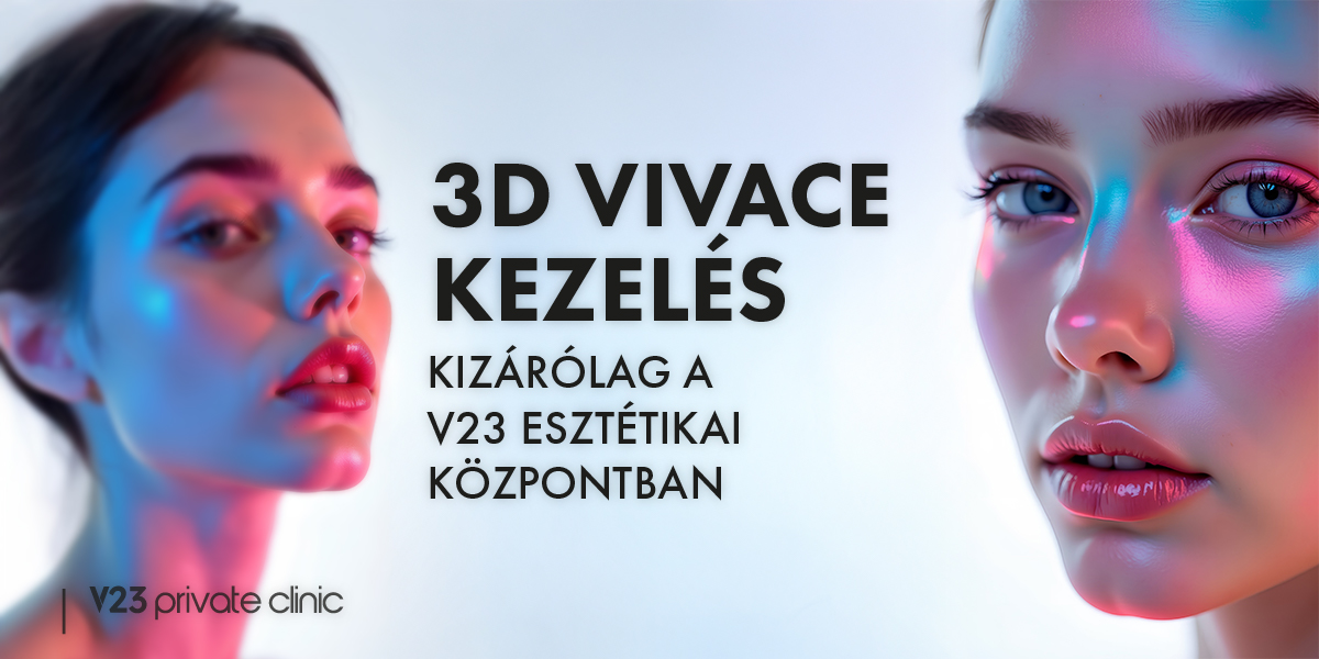 3D VIVACE KEZELÉS